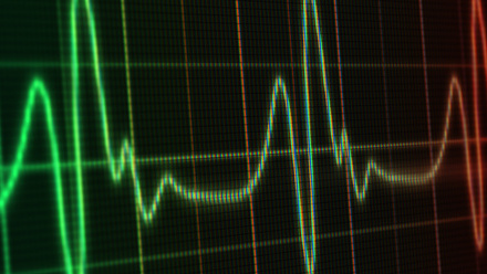 Engagement survey_Brand Pie blog.jpg 1